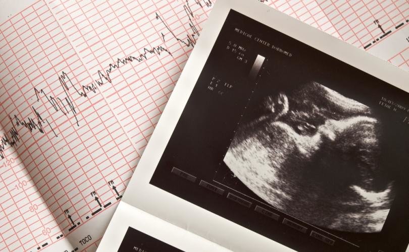 Техас стал первым американским штатом, где принят и вступил в силу закон, запрещающий делать аборты после того, как у плода начинает прослушиваться сердцебиение